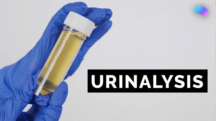 Urinalysis | Urine Dipstick Test | OSCE Guide | UKMLA | CPSA | PLAB 2