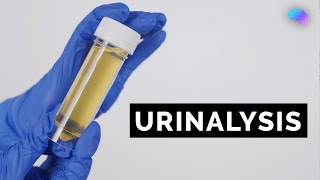 Urinalysis | Urine Dipstick Test | Osce Guide | Ukmla | Cpsa