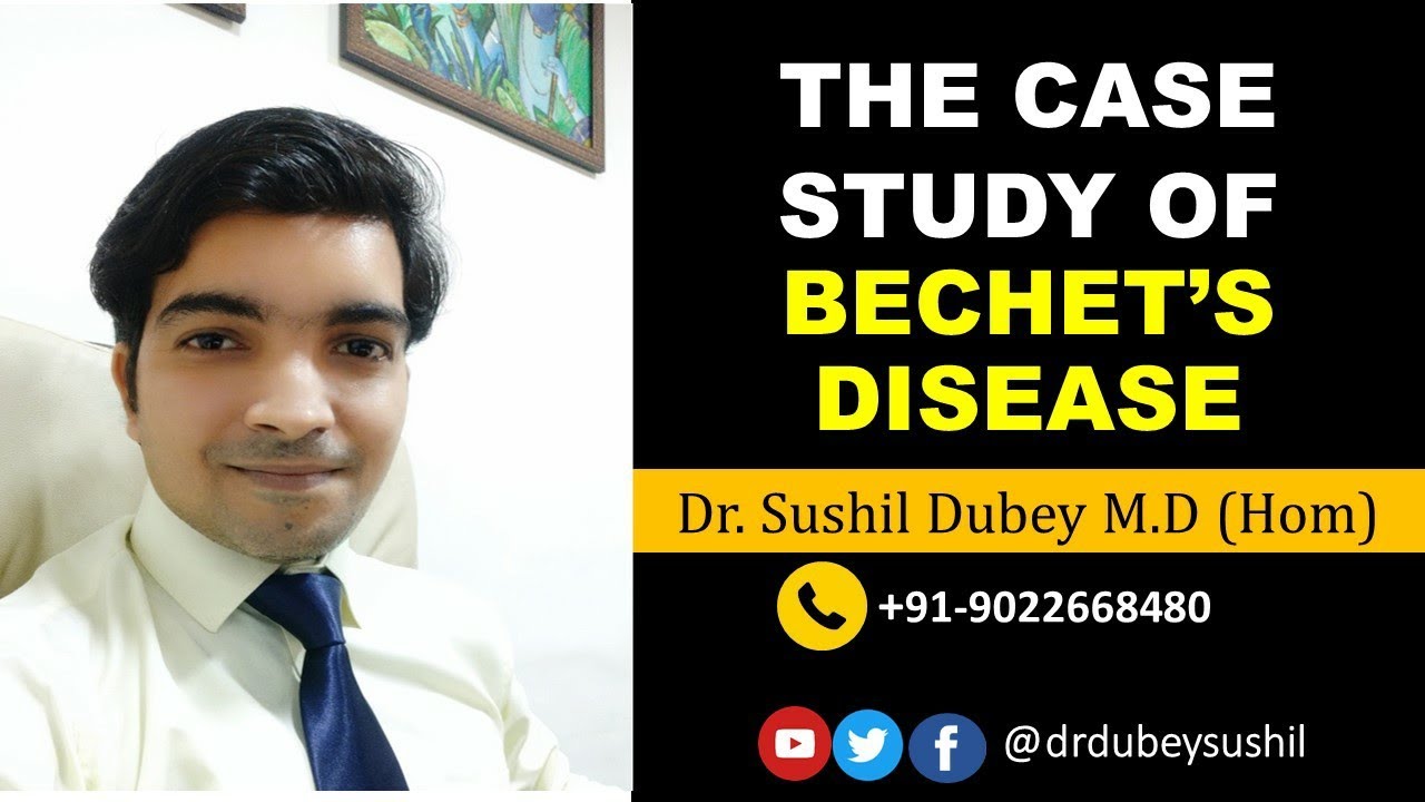 BECHETS DISEASE CASE STUDY DR SUSHIL DUBEY AEON HOMOEOPATHY BECHETS DISEASE CASE STUDY DR SUSHIL DUBEY AEON HOMOEOPATHY