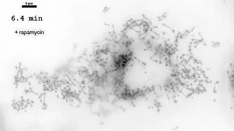 Johns Hopkins Medicine Researchers Advance Understanding of Why Cell Parts Look the Way They Do