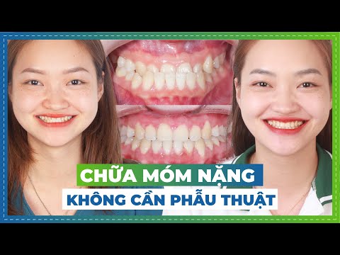 Katta chizilgan porno