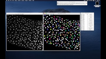 Nuclei segmentation using StarDist in Fiji/ImageJ