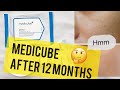 I ONLY USED MEDICUBE FOR A YEAR...| Before & After | Did it work? | Is it worth it? | Porepad Review