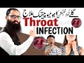 Homeopathic treatment for throat infections dr hafiz mustansar dhms