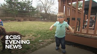 2yearold with spina bifida now running after taking inspiring first steps