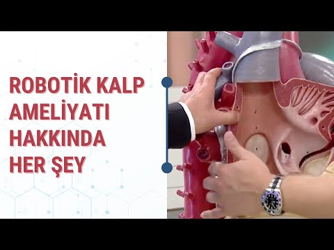 Doktor Geldi - Robotik Kalp Cerrahisi (26. Bölüm)