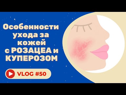 #50 Особенности ухода за кожей с розацеа и куперозом