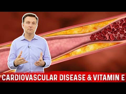 Coronary Heart Disease & Vitamin E Explained By Dr. Berg