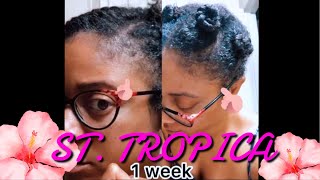 😮ST. Tropica Did This After 1 Week! | ST. Tropica 60 Day Hair Growth Challenge