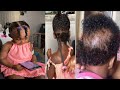 EASY PROTECTIVE STYLE FOR BABIES TODDLER HAIR GROWTH