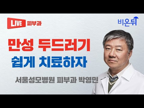   만성 두드러기 쉽게 치료하자 서울성모병원 피부과 박영민