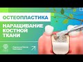 👆 Остеопластика - наращивание костной ткани