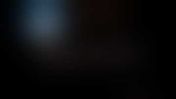 Robotic Right Hemicolectomy Inferior Approach (CME)