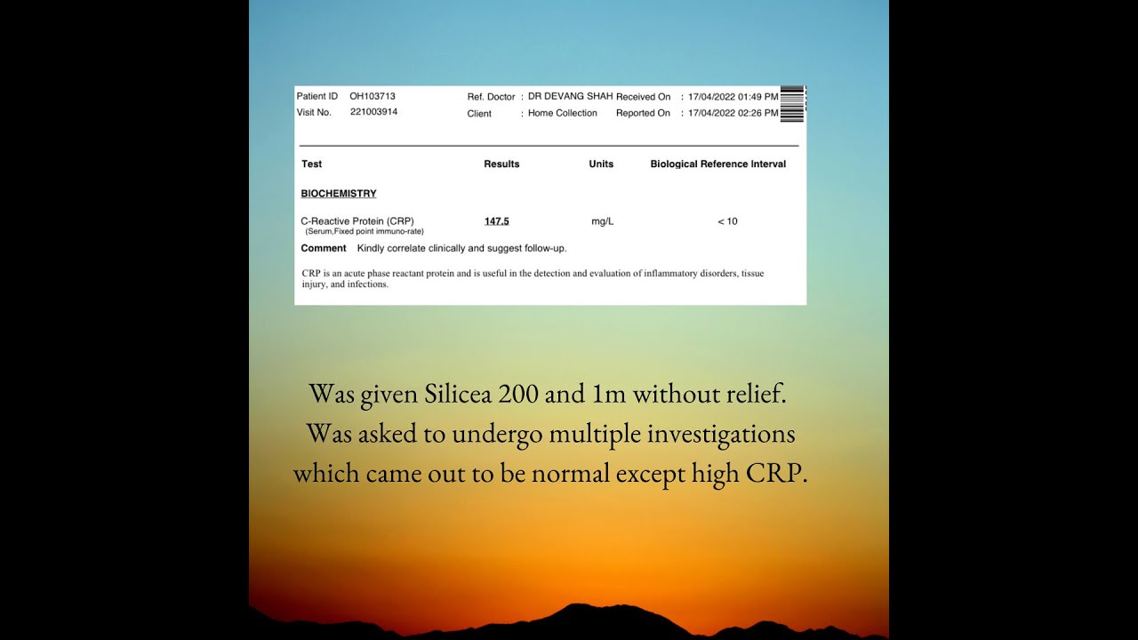 The simple technique to crack fevers and acutes.