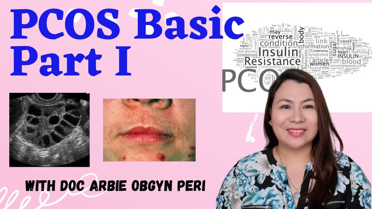 OBGYNE: PCOS BASIC PART 1