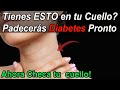 ¿Se ve ESTO en tu Cuello? Tendrás un 52% más de riesgo de Diabetes