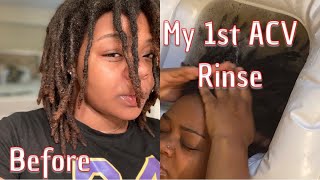 IM SHOOK! | Loc Update | My First ACV Rinse |