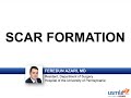 USMLE-Rx Express Video of the Week: Scar Formation