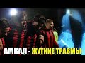 АМКАЛ - ЖУТКИЕ ТРАВМЫ, ПЕРЕЛОМЫ