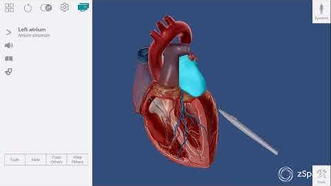 Heart Tour on zSpace