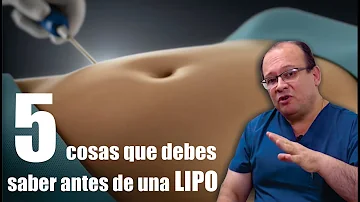 ¿Qué no hacer antes de una liposucción?