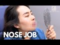 My Rhinoplasty Journey in Korea | Seoul Guide Medical