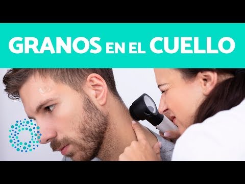 Vídeo: Cómo Tratar Un Grano En El Cuello
