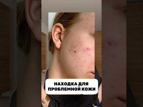 НАХОДКА ДЛЯ ПРОБЛЕМНОЙ