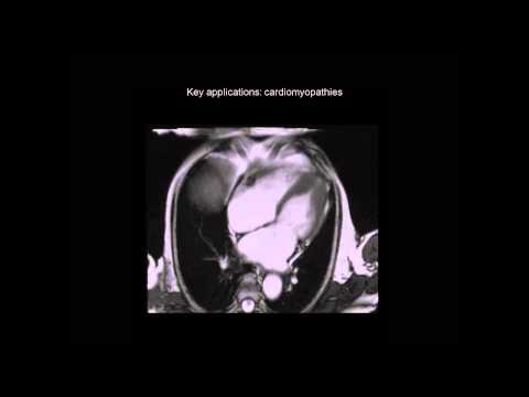 Indications for Cardiac Magnetic Resonance Imaging