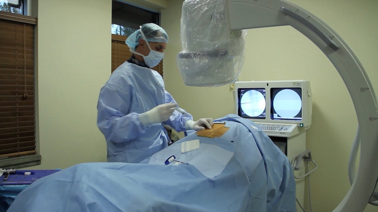 Kyphoplasty for Vertebral Body Compression Fracture mrid дикий яд ремикс