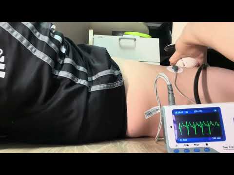 Irregular heartbeat pressing with a bed