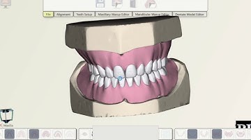 Prosthetic Design Centre (PDC) Digital Denture Tooth Setup