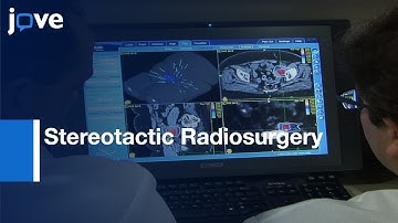 Stereotactic Radiosurgery For Gynecologic Cancer l Protocol Preview
