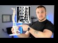 Back Pain Imaging Explained by a Physical Therapist - Do You Really Need an MRI or X-Ray?