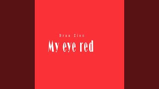 My eye red