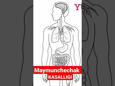 MAYMUNCHECHAK KASALLIGI… 🐒