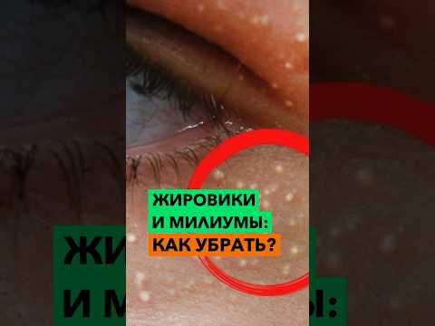 Как избавиться от