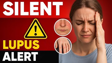 Lupus Disease: 10 Hidden Symptoms That Can Wreck Your Health