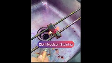 Ziehl Neelsen staining/ZN staining/AFB staining #Afb #tb #znstain