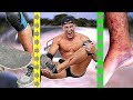 Skateboards VS My Shins *INSANE BRUISING* | Bodybuilder VS Crazy Skating Experiment