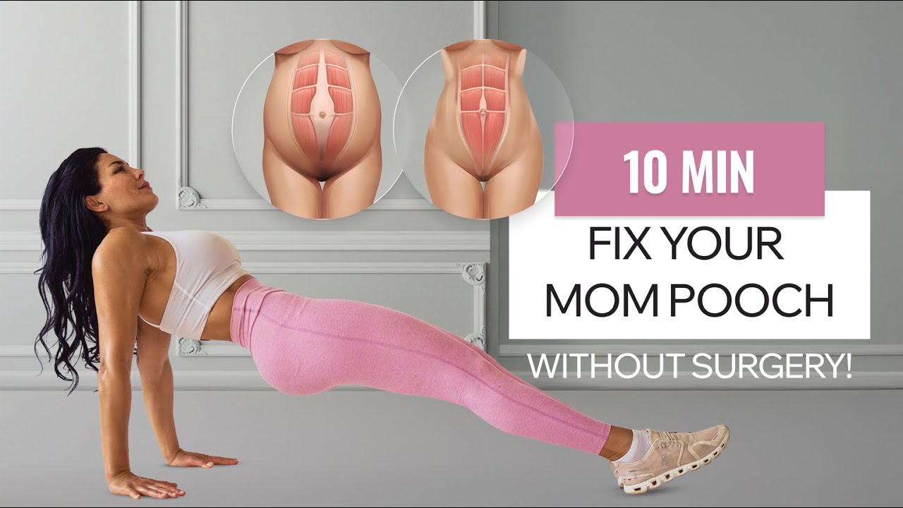 Fix Your Mom Pooch WITHOUT Surgery 🔥
