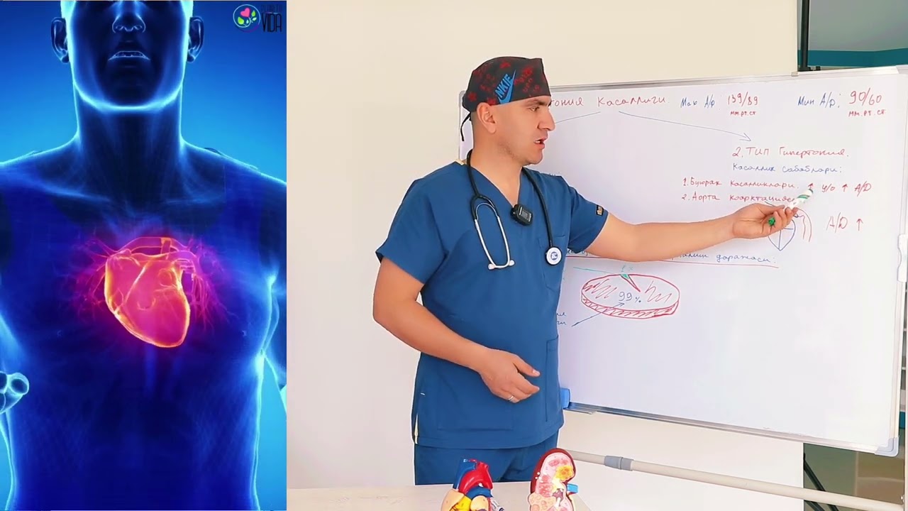GIPERTONIYA. KARDIOLOG, TERAPEVT