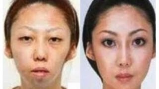 Man Sues Wife Over Secret Plastic Surgery - and Wins! | China Uncensored