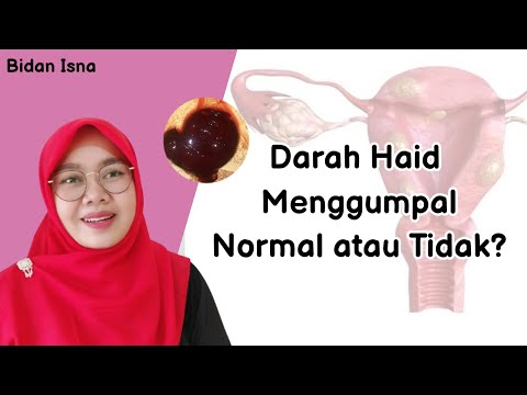 Video: Di manakah gumpalan ais ditemui?