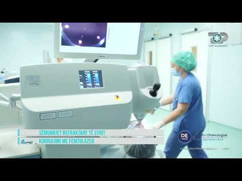 Video: Bëni pas operacionit lazer të syve?