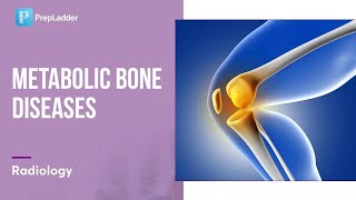 Bone disease and precautions