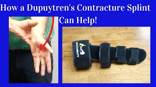 How a Dupuytren's Contracture Splint Helps!