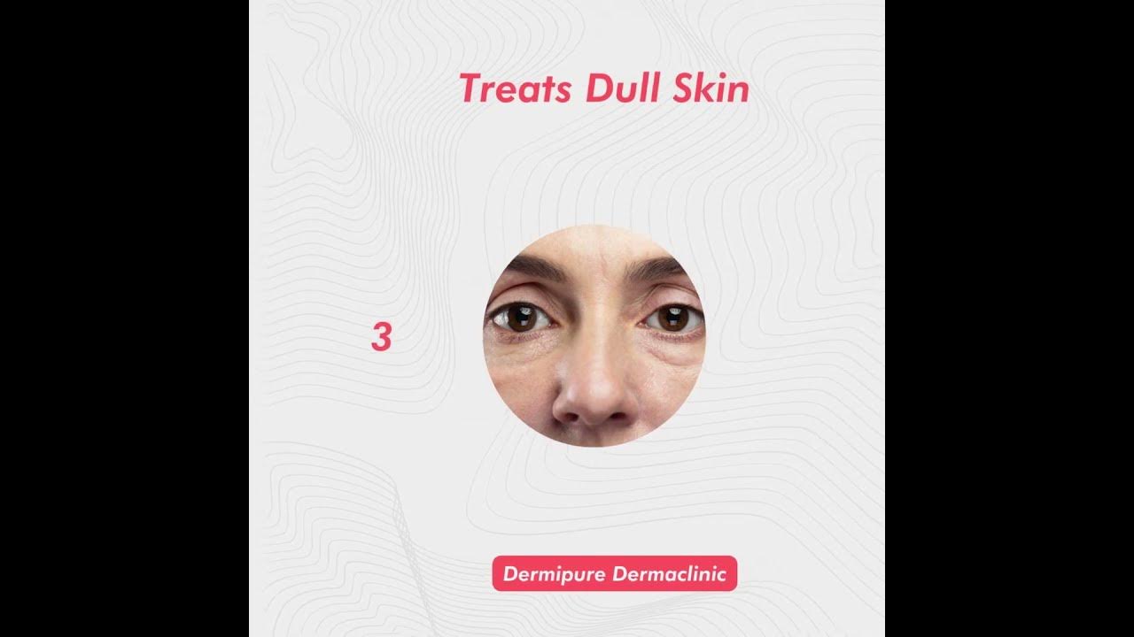 vitamin-c-can-be-used-for-dermipure-dermaclinic-adyar-chennai