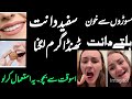 #gums#whitining#bleedinggums/مسوڑوں سے خون آنے اور ہلتے دانتوں کیلے تحفہ / herbalist ishaq farrukh