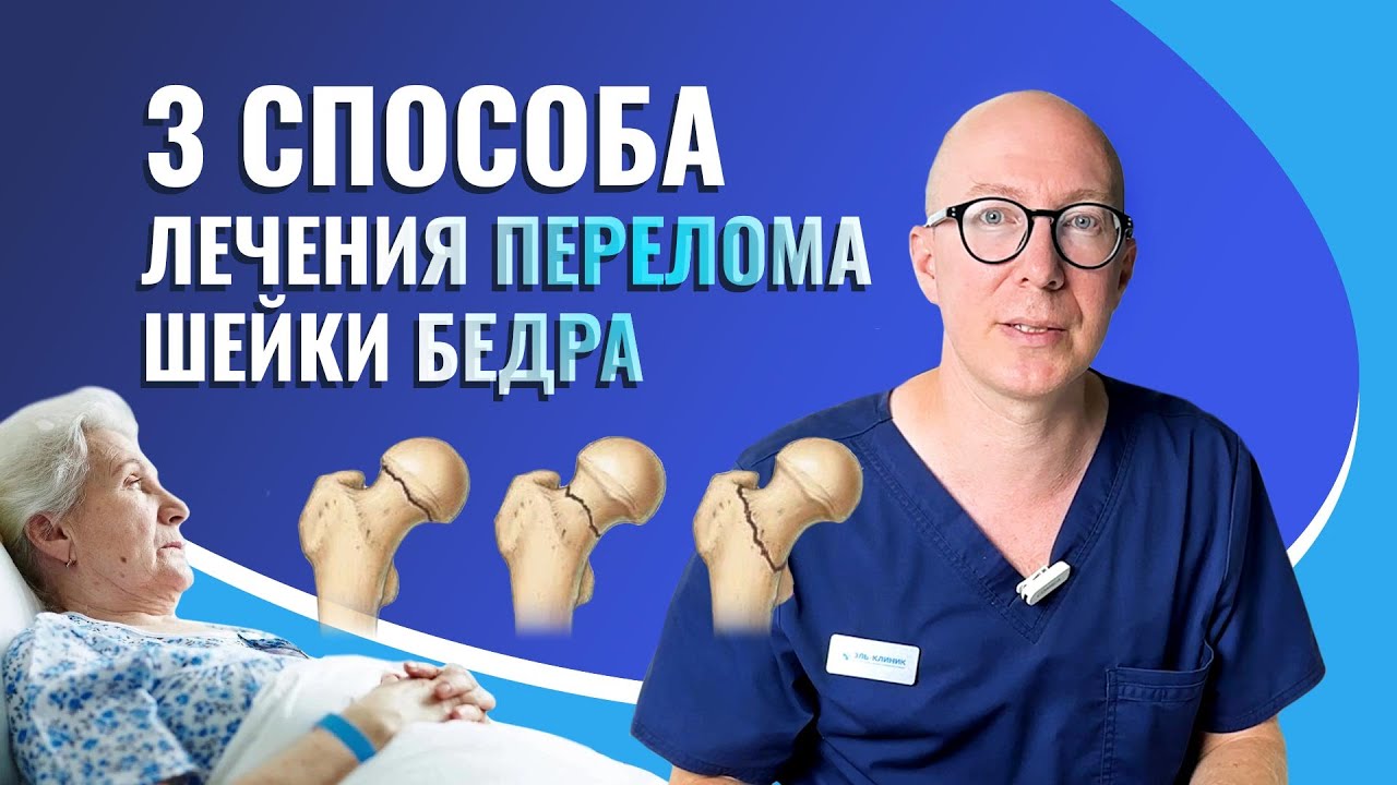 3 способа лечения перелома шейки бедра.